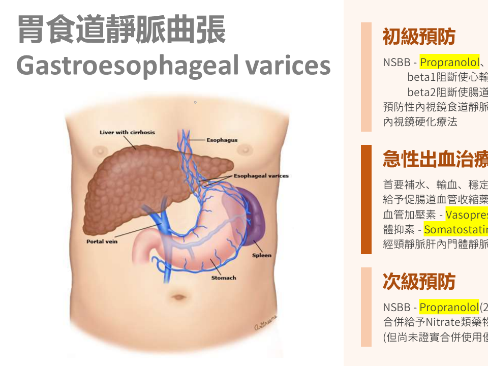 胃食道靜脈曲張藥物治療與疾病簡介 少年維特藥學部落格