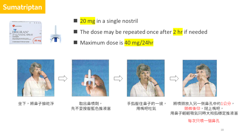 偏頭痛急性發作治療與預防