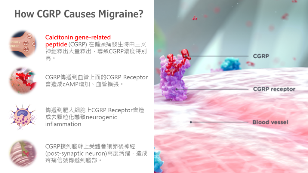 偏頭痛急性發作治療與預防